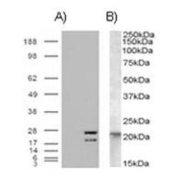 Western Blot: NRAS Antibody [NB100-94887] - A) HEK293 over expressing NRAS and probed with NRAS (mock transfection in first lane) B) (0.01ug/ml) staining of A431 lysate (35ug protein in RIPA buffer).Primary incubation was 1 hour. Detected by chemiluminescence.