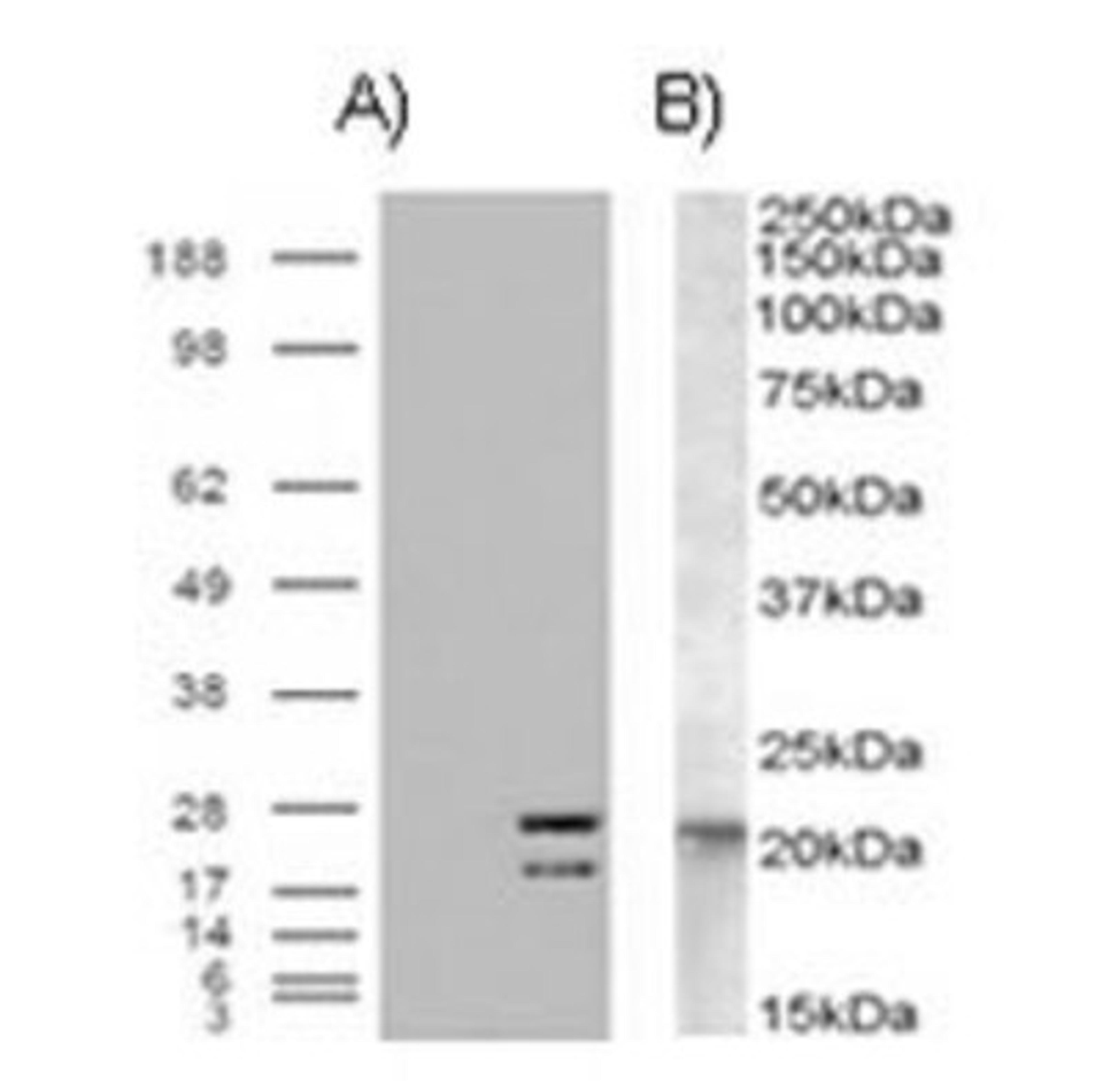 Western Blot: NRAS Antibody [NB100-94887] - A) HEK293 over expressing NRAS and probed with NRAS (mock transfection in first lane) B) (0.01ug/ml) staining of A431 lysate (35ug protein in RIPA buffer).Primary incubation was 1 hour. Detected by chemiluminescence.