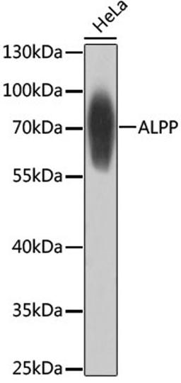 Western blot - ALPP antibody (A6353)