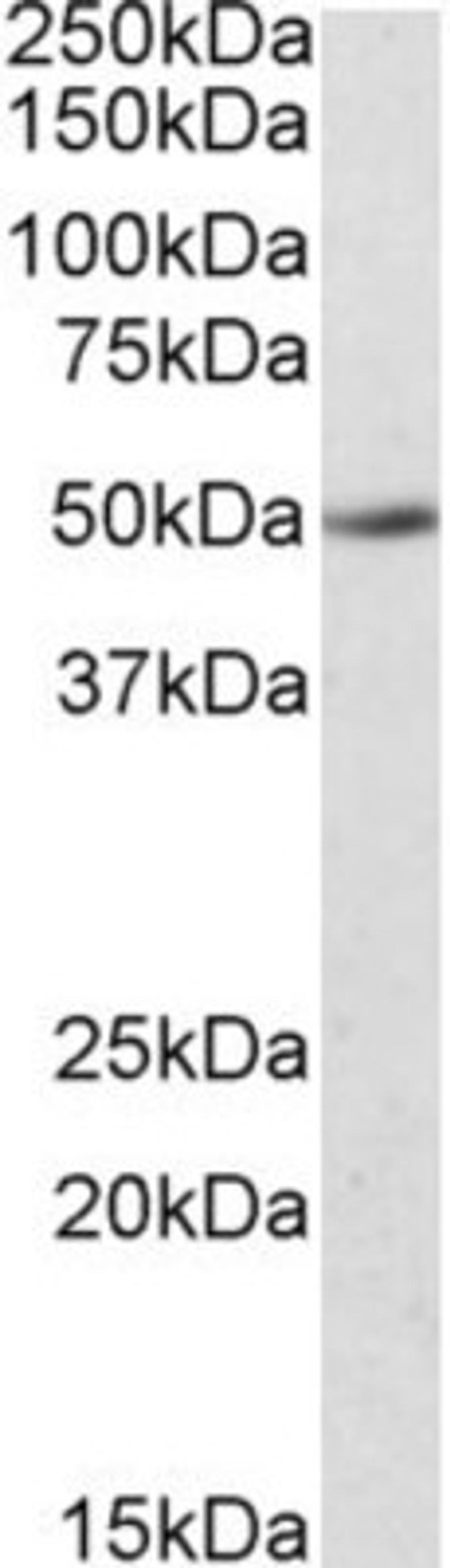 Western Blot: IDO2 Antibody [NBP1-45209] - (0.5ug/ml) staining of Human Kidney lysate (35ug protein in RIPA buffer) with (B) and without (A) blocking with the immunising peptide. Primary incubation was 1 hour. Detected by chemiluminescence.