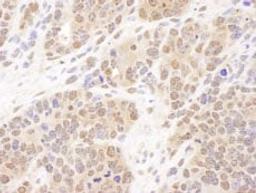 Detection of mouse PSMB7 by immunohistochemistry.