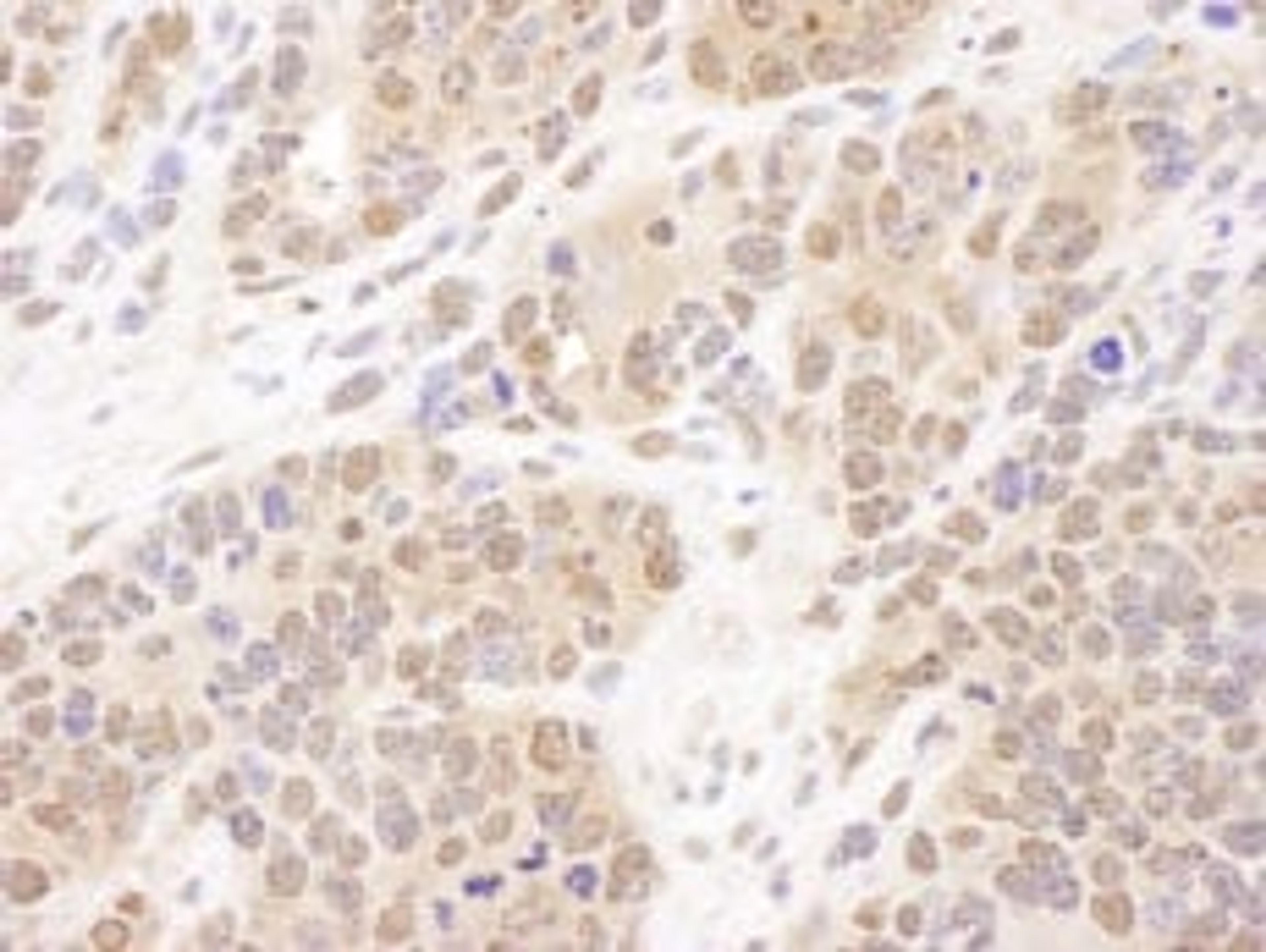 Detection of mouse PSMB7 by immunohistochemistry.