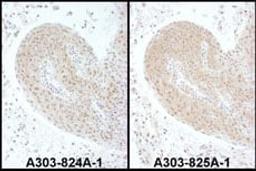 Detection of human PSMC6 by immunohistochemistry.