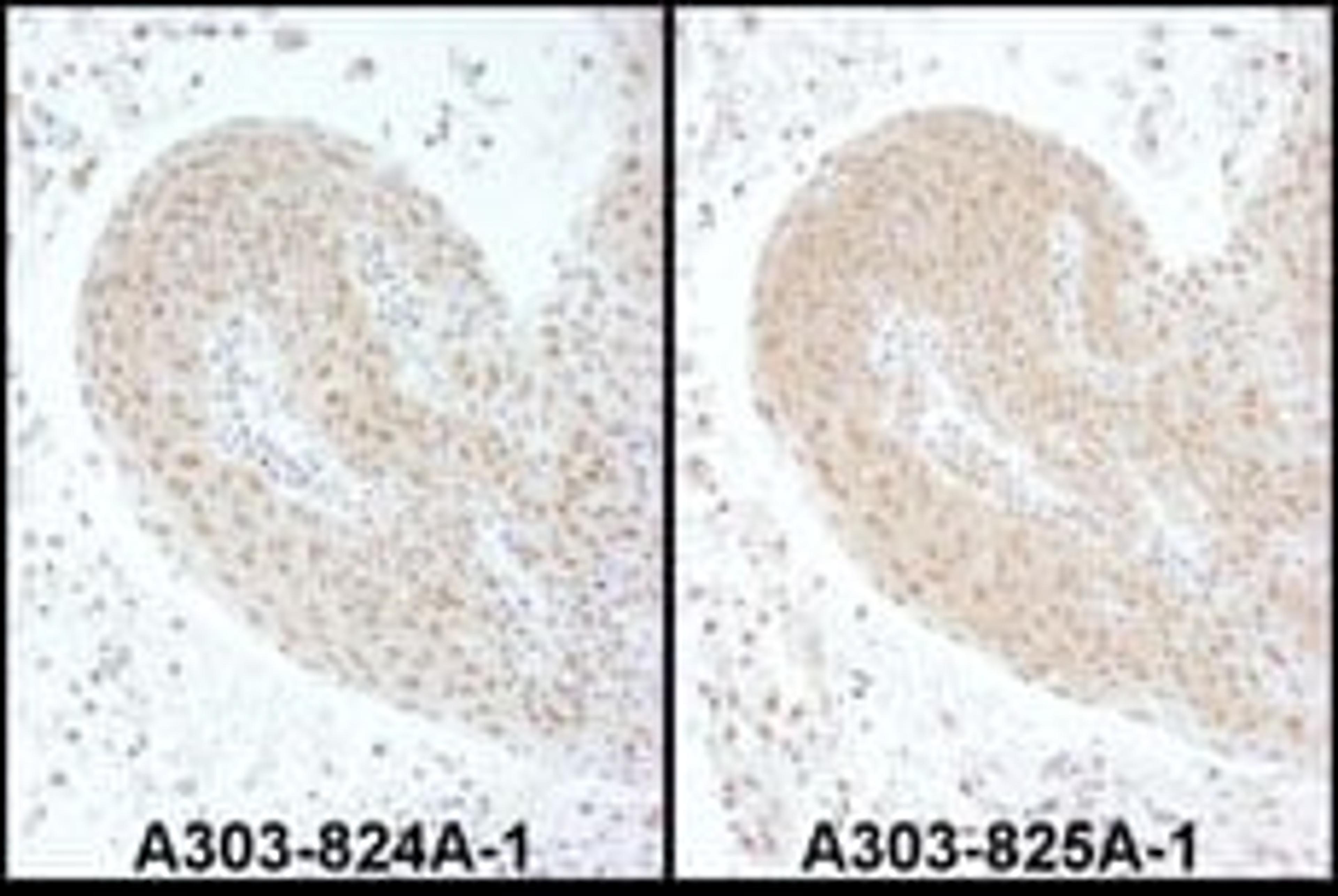 Detection of human PSMC6 by immunohistochemistry.