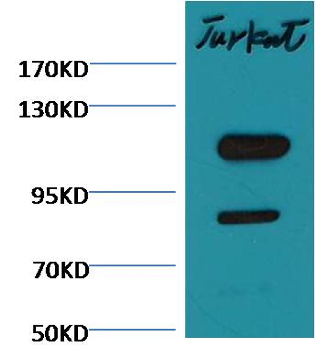 Western blot analysis of Jurkat cell lysates using Cleaved PARP antibody