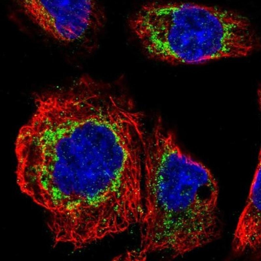 Immunocytochemistry/Immunofluorescence: FAM73A Antibody [NBP1-93832] - Staining of human cell line A-431 shows positivity in mitochondria.