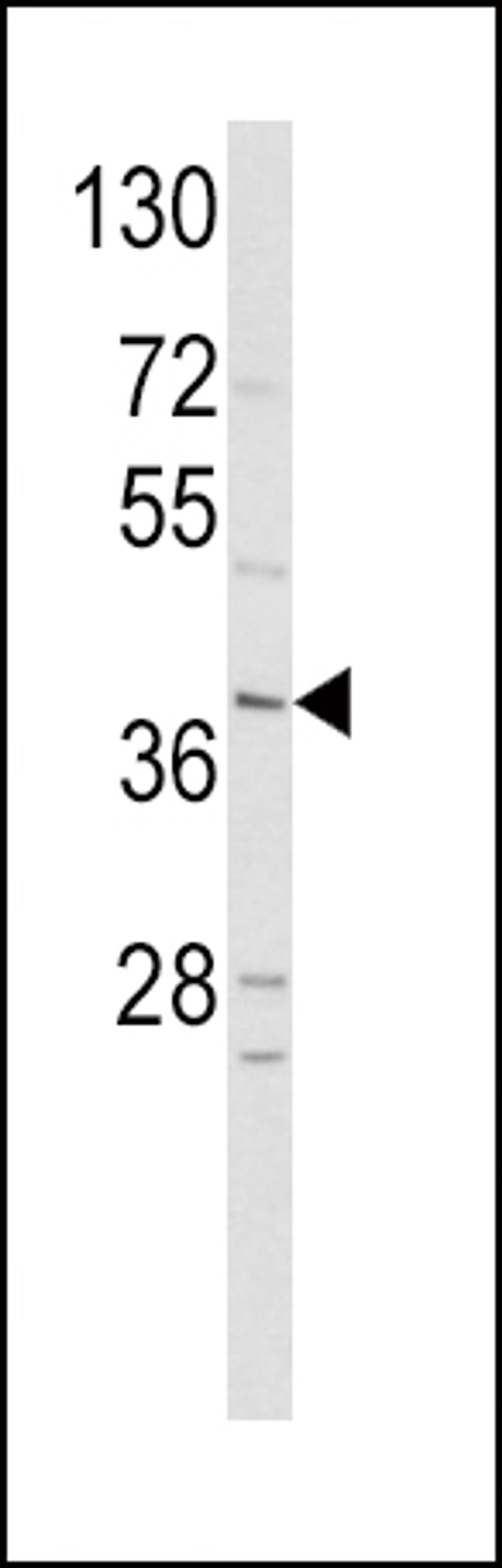 Western blot analysis of hNeuroD1-Q30 in HepG2 cell line lysates (35ug/lane)