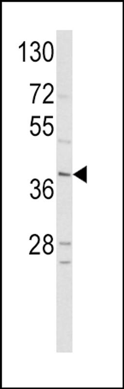 Western blot analysis of hNeuroD1-Q30 in HepG2 cell line lysates (35ug/lane)