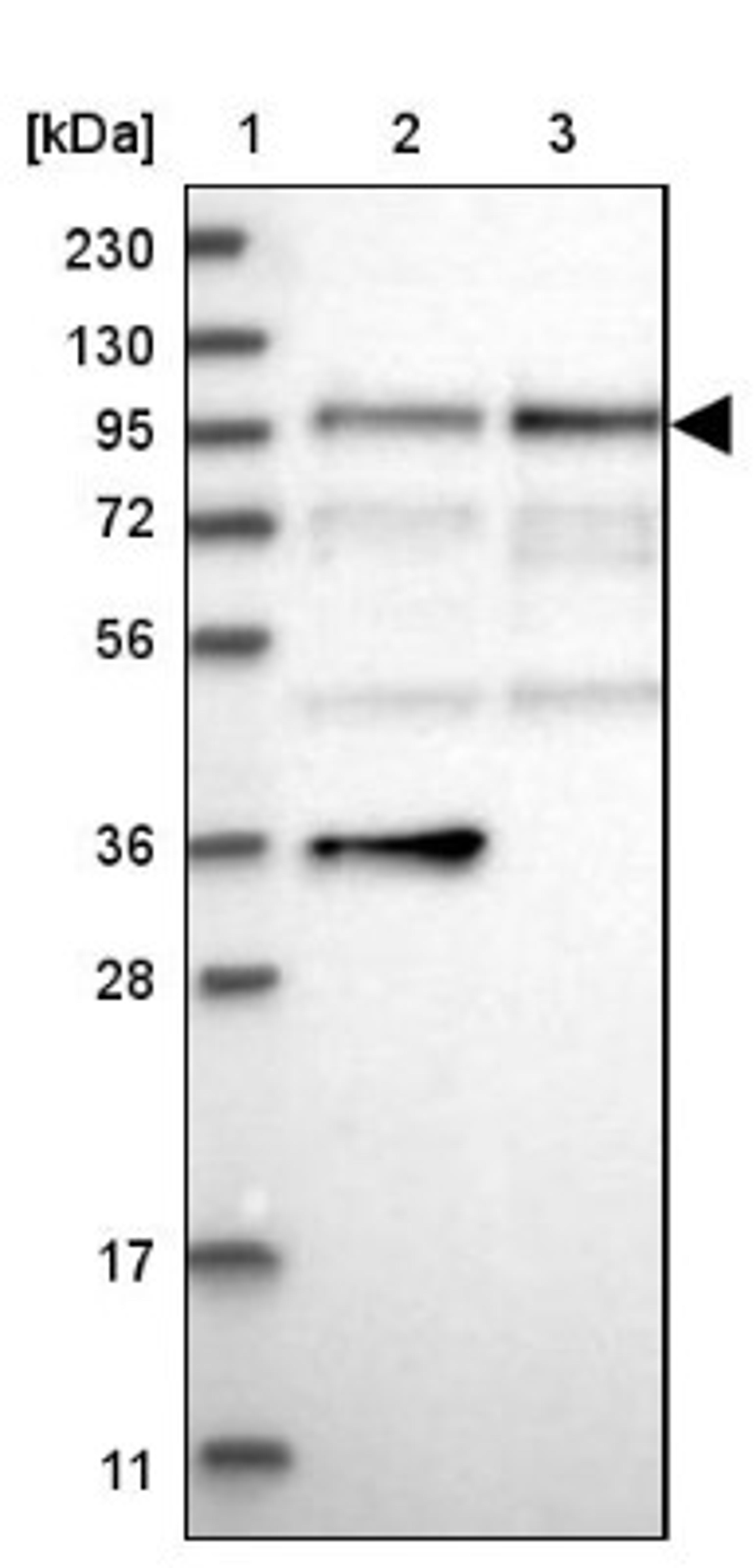 Western Blot: DAB2 Antibody [NBP2-33915] - Lane 1: Marker [kDa] 230, 130, 95, 72, 56, 36, 28, 17, 11<br/>Lane 2: Human cell line RT-4<br/>Lane 3: Human cell line U-251MG sp