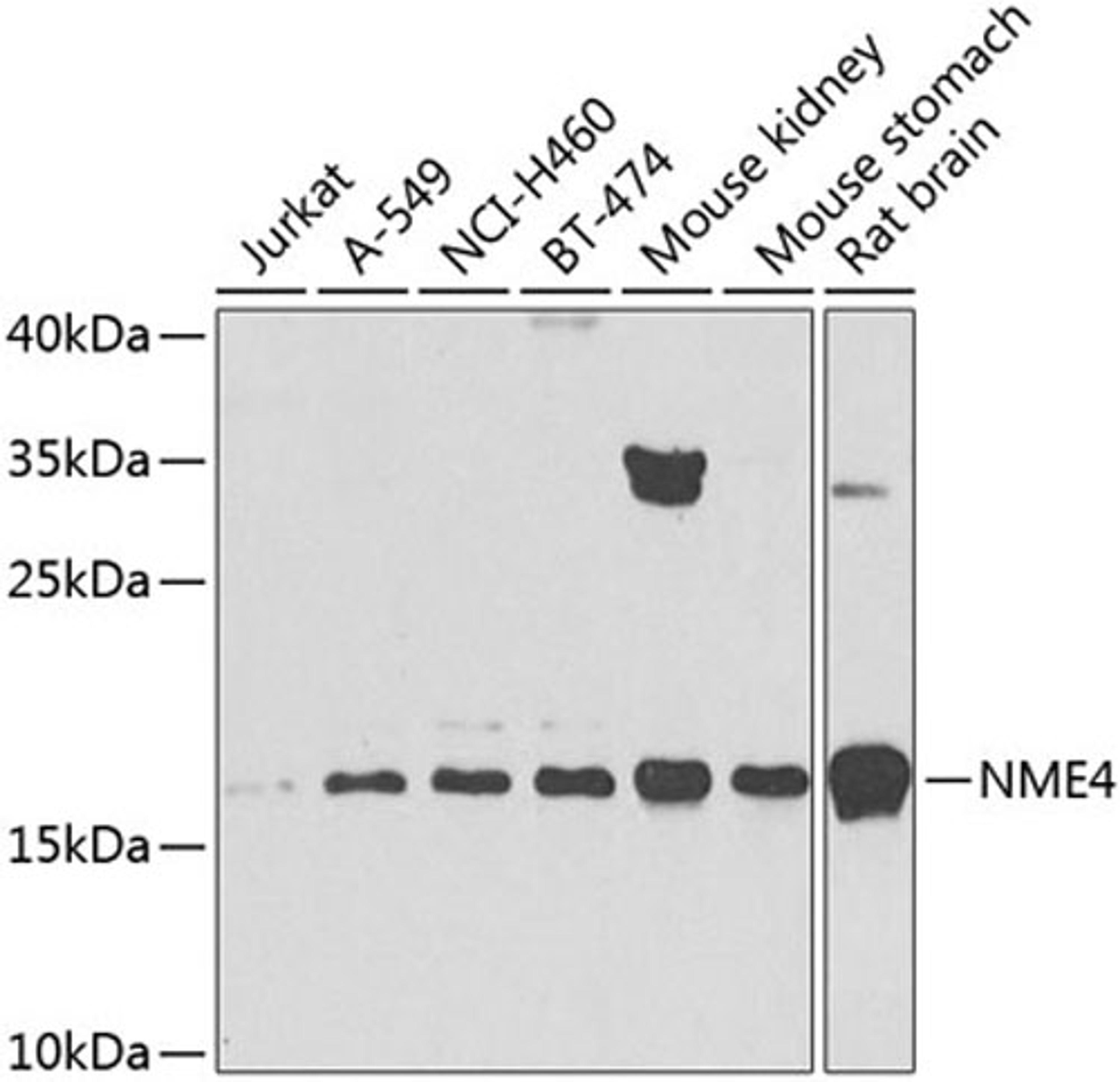 Western blot - NME4 antibody (A8350)