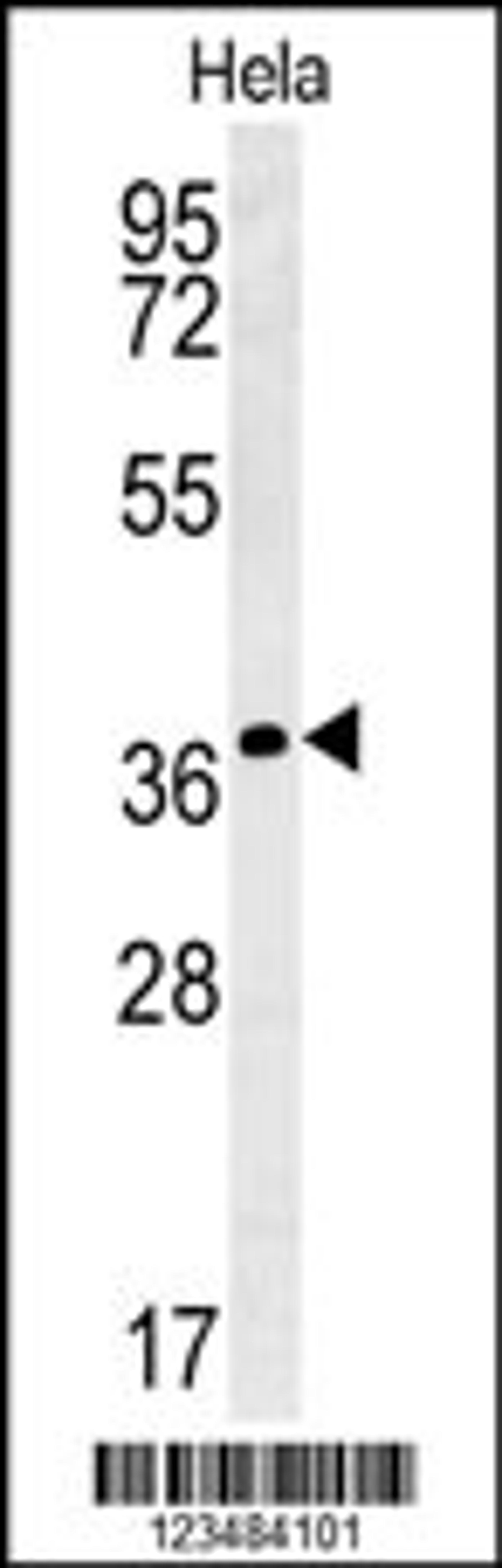 Western blot analysis in Hela cell line lysates (35ug/lane).