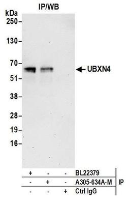 Detection of human UBXN4 by WB of IP.