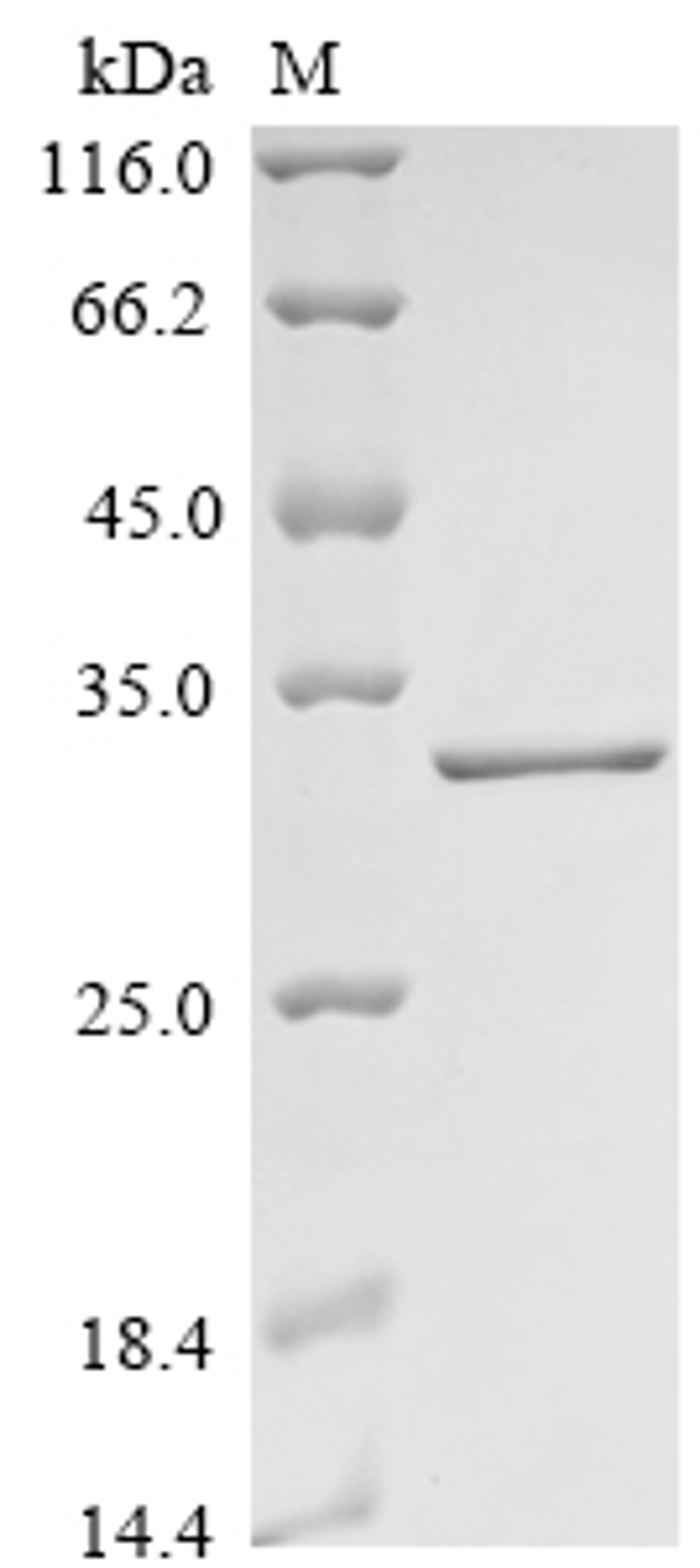 (Tris-Glycine gel) Discontinuous SDS-PAGE (reduced) with 5% enrichment gel and 15% separation gel.