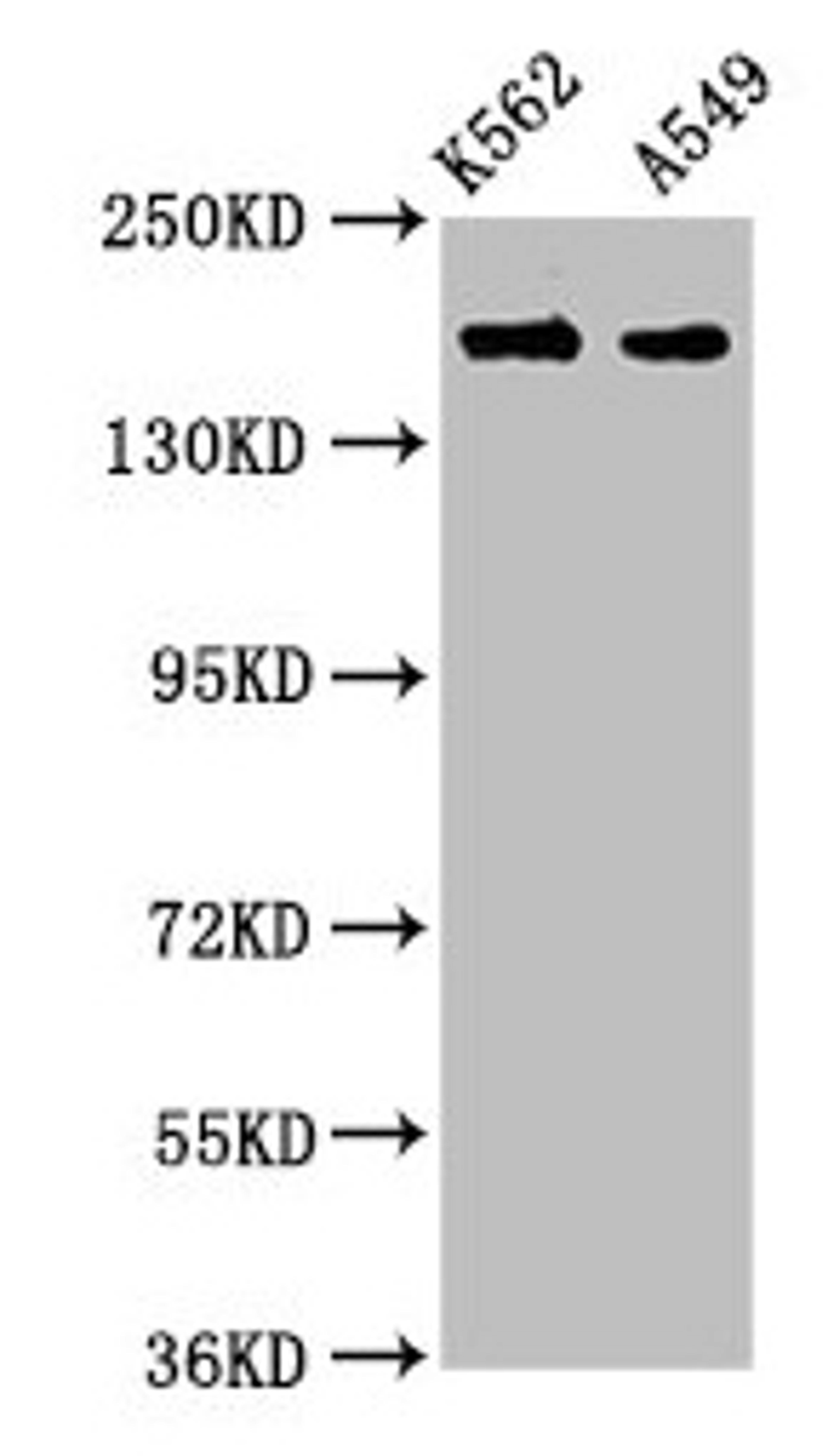 Western Blot. Positive WB detected in: K562 whole cell lysate, A549 whole cell lysate. All lanes: FMN1 antibody at 3.9µg/ml. Secondary. Goat polyclonal to rabbit IgG at 1/50000 dilution. Predicted band size: 158, 72, 54, 133 kDa. Observed band size: 158 kDa