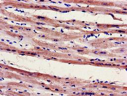 Immunohistochemistry of paraffin-embedded human heart tissue using CSB-PA800226LA01HU at dilution of 1:100