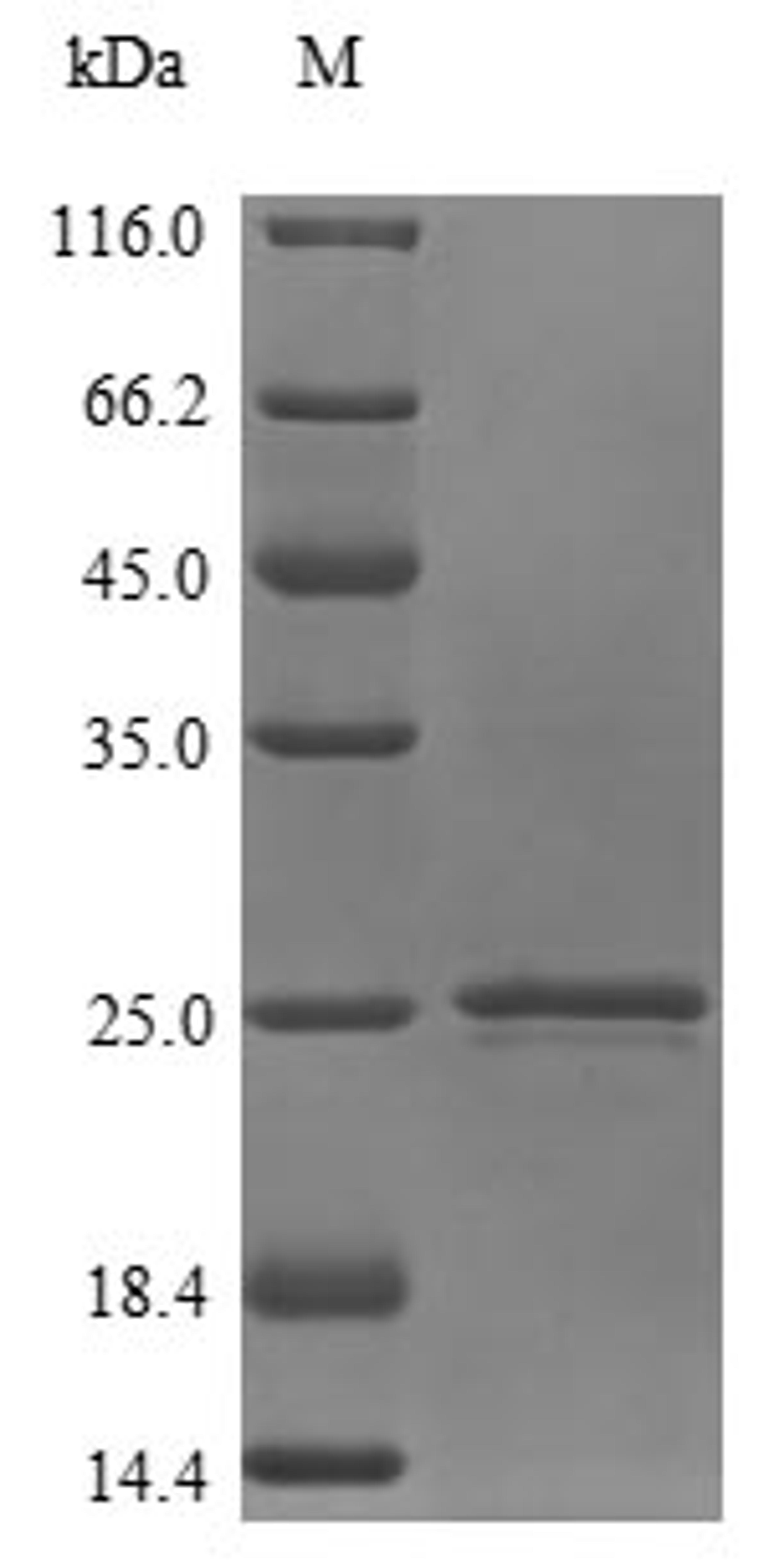 (Tris-Glycine gel) Discontinuous SDS-PAGE (reduced) with 5% enrichment gel and 15% separation gel.