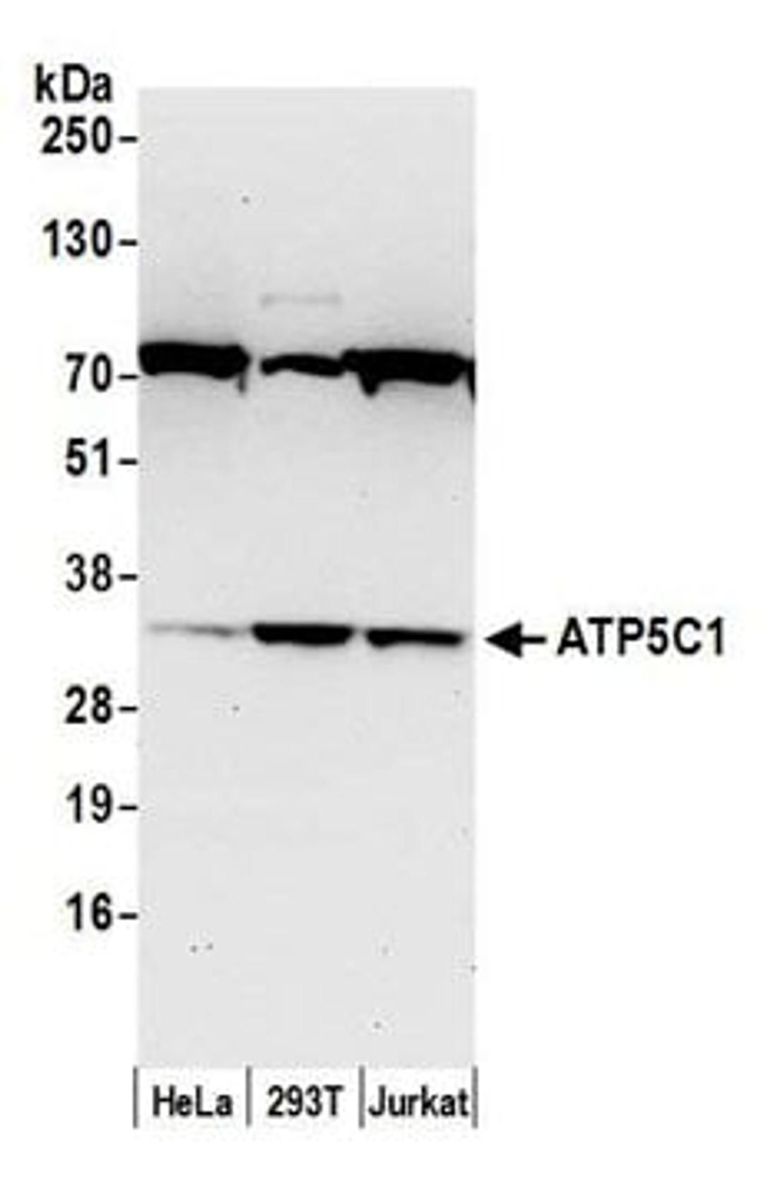 Detection of human ATP5C1 by western blot.