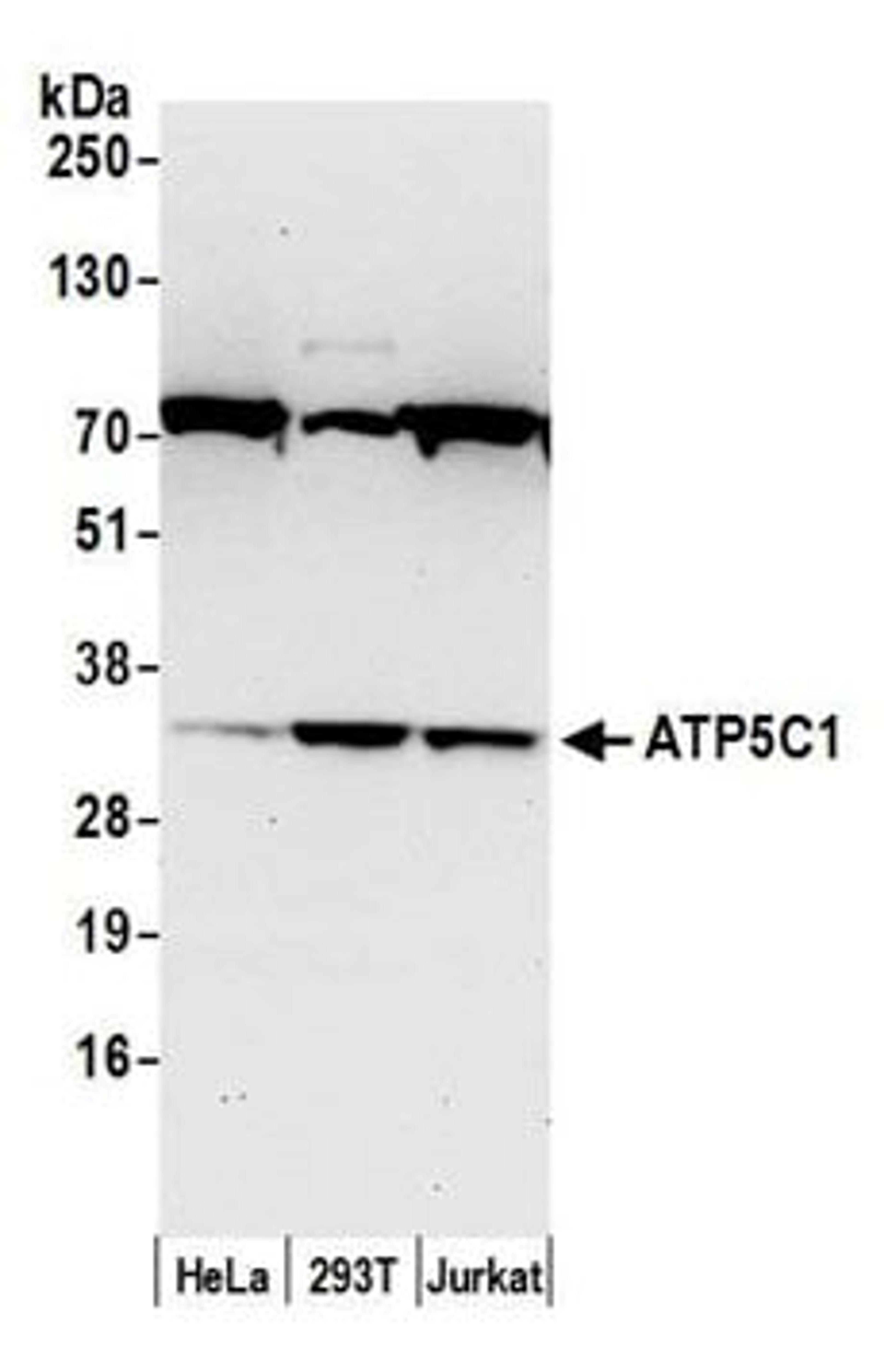 Detection of human ATP5C1 by western blot.