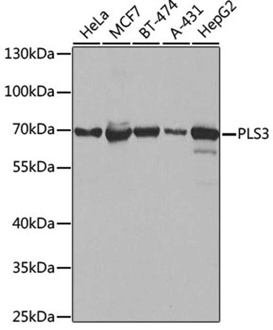 Western blot - PLS3 antibody (A3627)