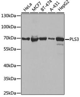 Western blot - PLS3 antibody (A3627)