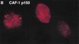 Immunocytochemistry/Immunofluorescence: CHAF1A Antibody (SS 1 1-13) [NB500-207] - Immunofluorescent staining of CAF-1-p150 in HeLa cells (Shibahara et al 1999).