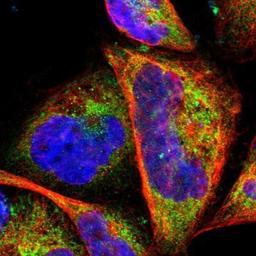 Immunocytochemistry/Immunofluorescence: LRRK1 Antibody [NBP1-82091] Staining of human cell line A-431 shows positivity in cytoplasm & mitochondria.