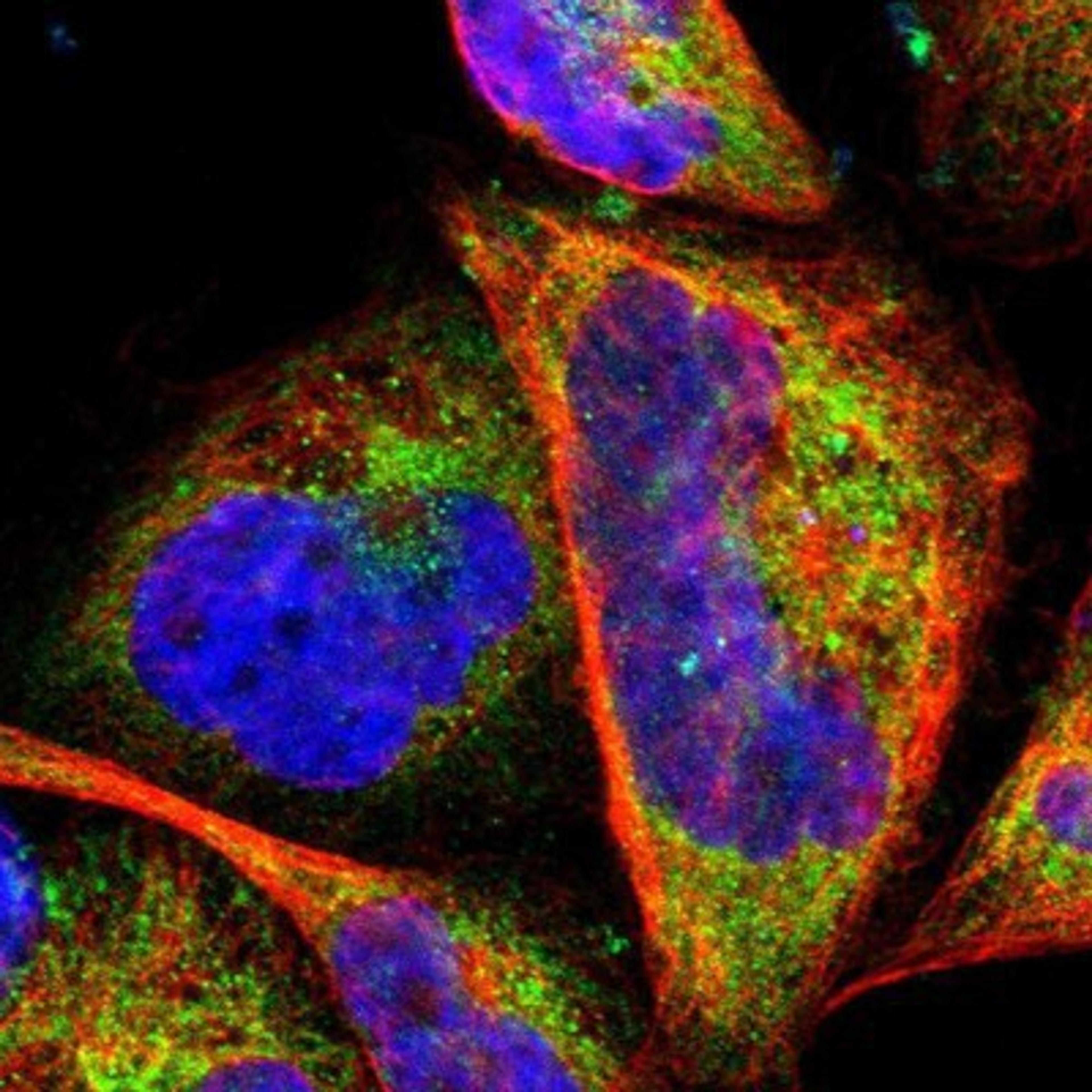 Immunocytochemistry/Immunofluorescence: LRRK1 Antibody [NBP1-82091] Staining of human cell line A-431 shows positivity in cytoplasm & mitochondria.