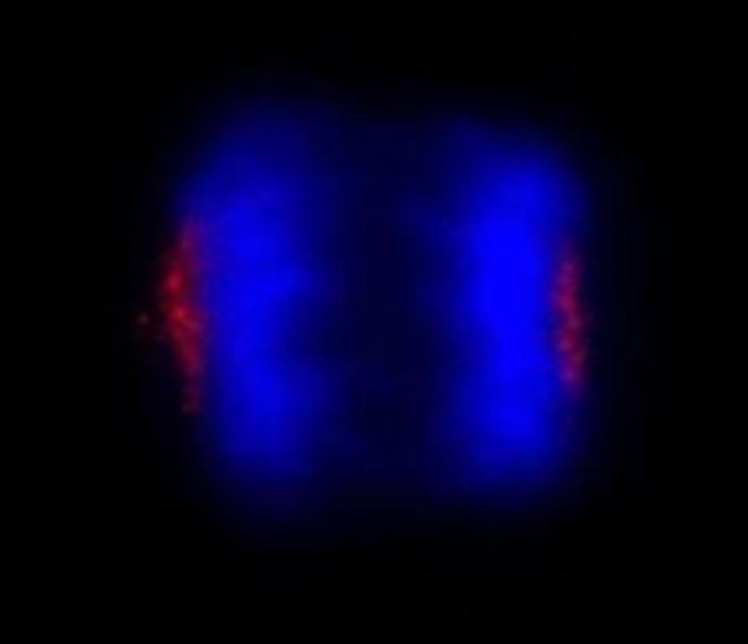 Detection of human CEP170 by immunocytochemistry.