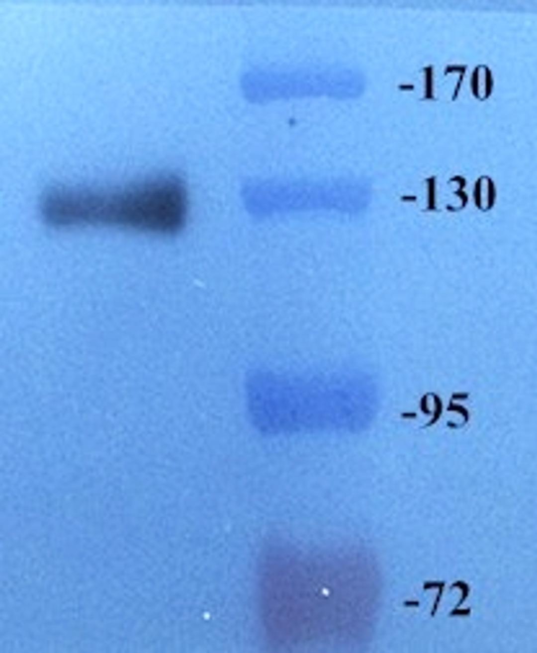 Western blot analysis of rat lung tissue using anti-CD163 (dilution of primary antibody at 1:500)