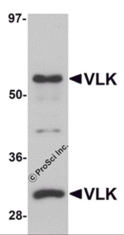 Western blot analysis of VLK in human lung tissue lysate with VLK antibody at 1 μg/mL.