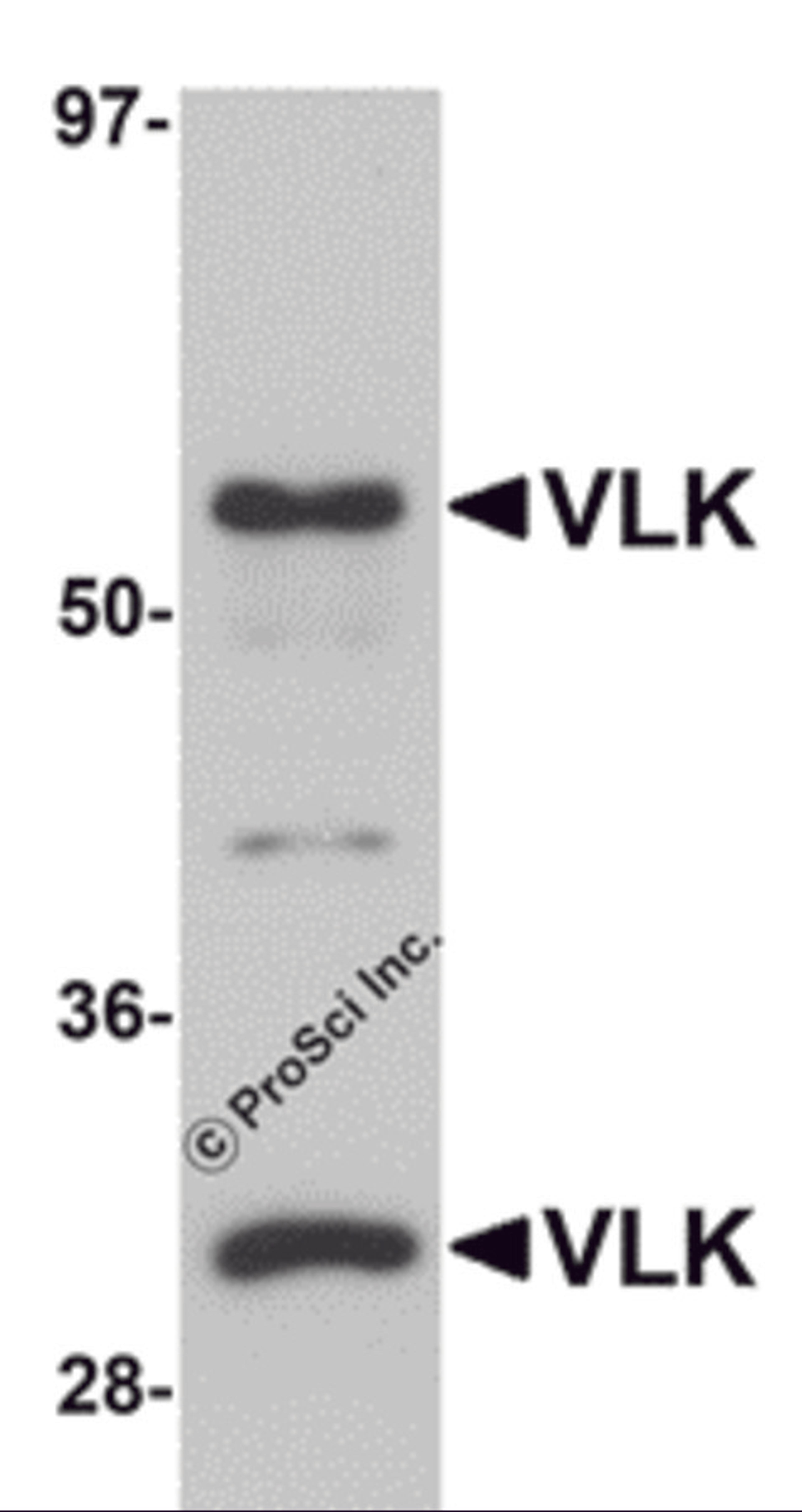 Western blot analysis of VLK in human lung tissue lysate with VLK antibody at 1 μg/mL.