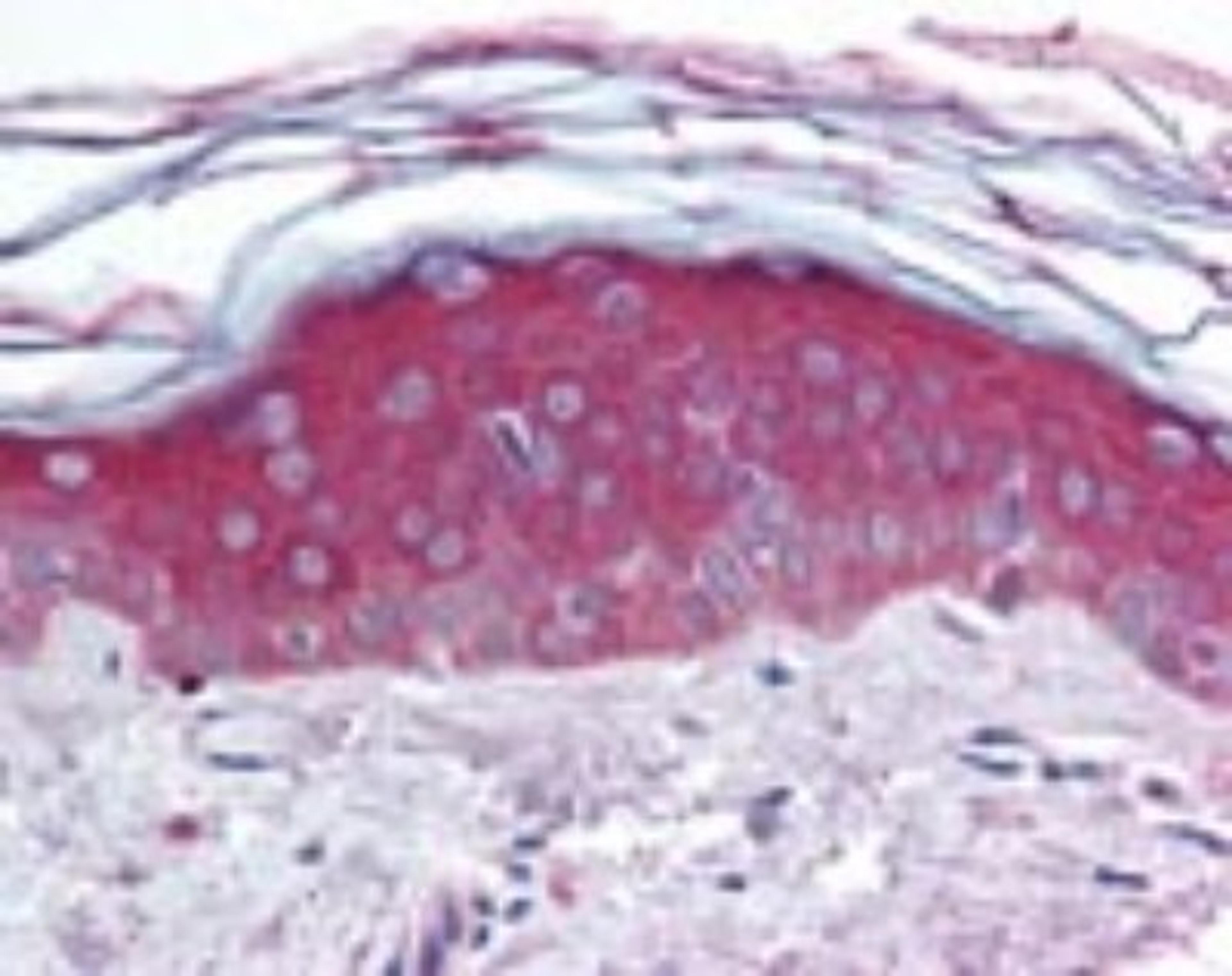 Immunohistochemistry-Paraffin: ARHGEF11 Antibody [NBP2-24517] - IHC analysis of human skin using NBP2-24517 at 10 ug/ml.