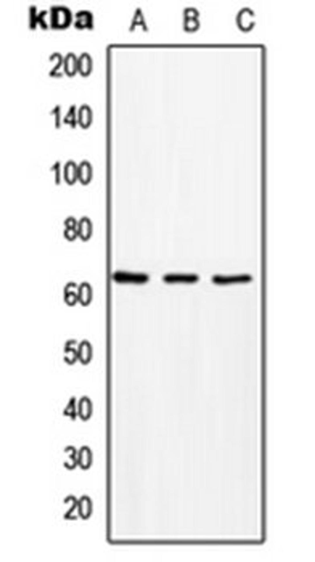 Western blot analysis of HeLa (Lane 1), Raw264.7 (Lane 2), rat kidney (Lane 3) whole cell lysates using SLC16A2 antibody