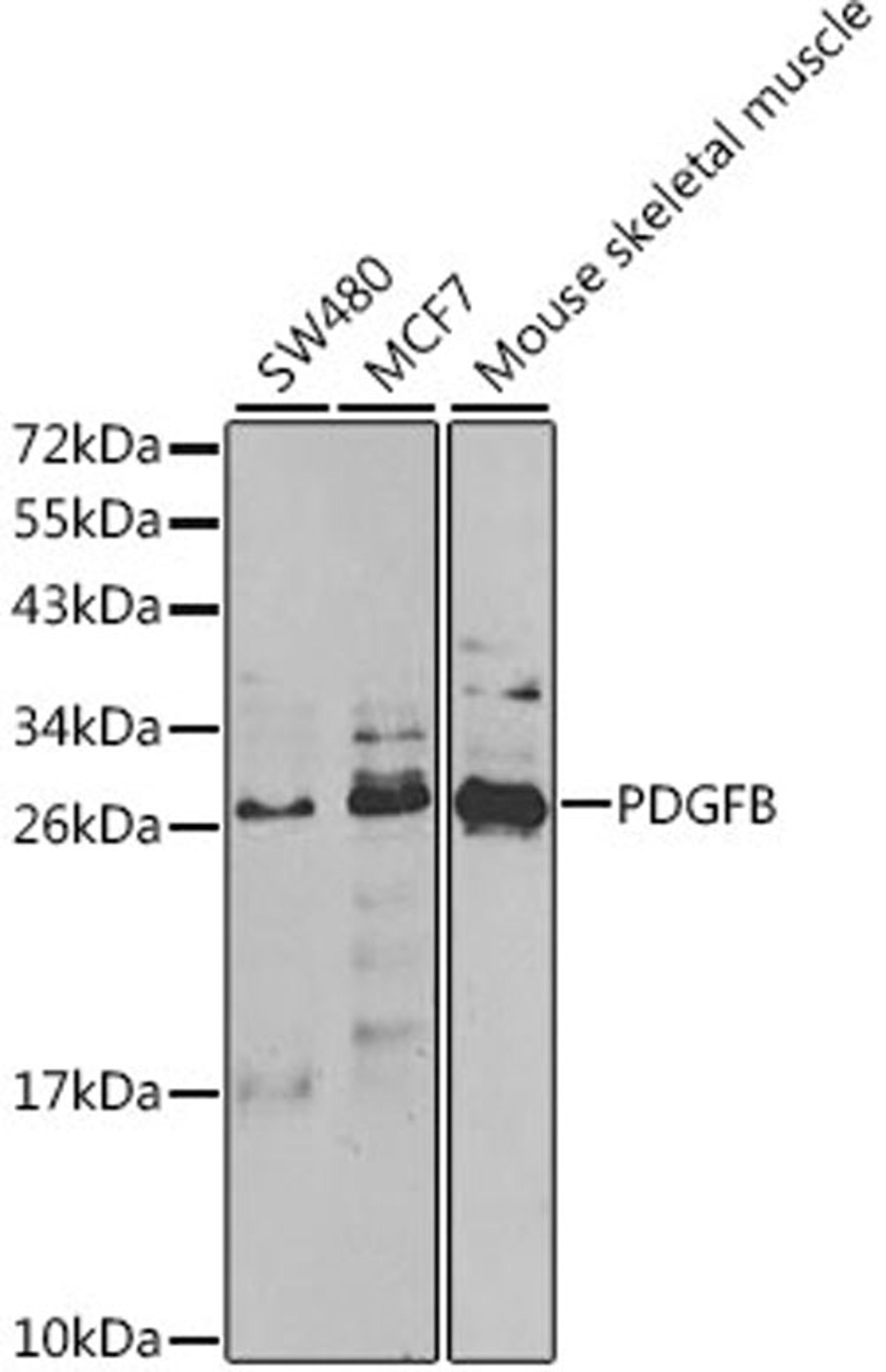 Western blot - PDGFB antibody (A1195)