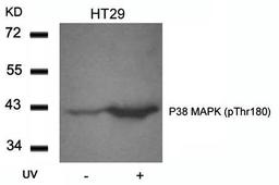 Western blot analysis of P38 MAPK(Phospho-Thr180) antibody in HT29 cells lysates