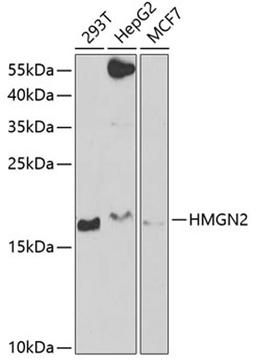 Western blot - HMGN2 antibody (A6156)