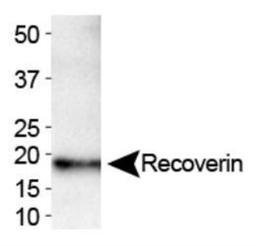 Western Blot: Recoverin Antibody (6A55CD6) [NB300-280]-Western blot analysis of Recoverin expression in human brain using NB300-280.