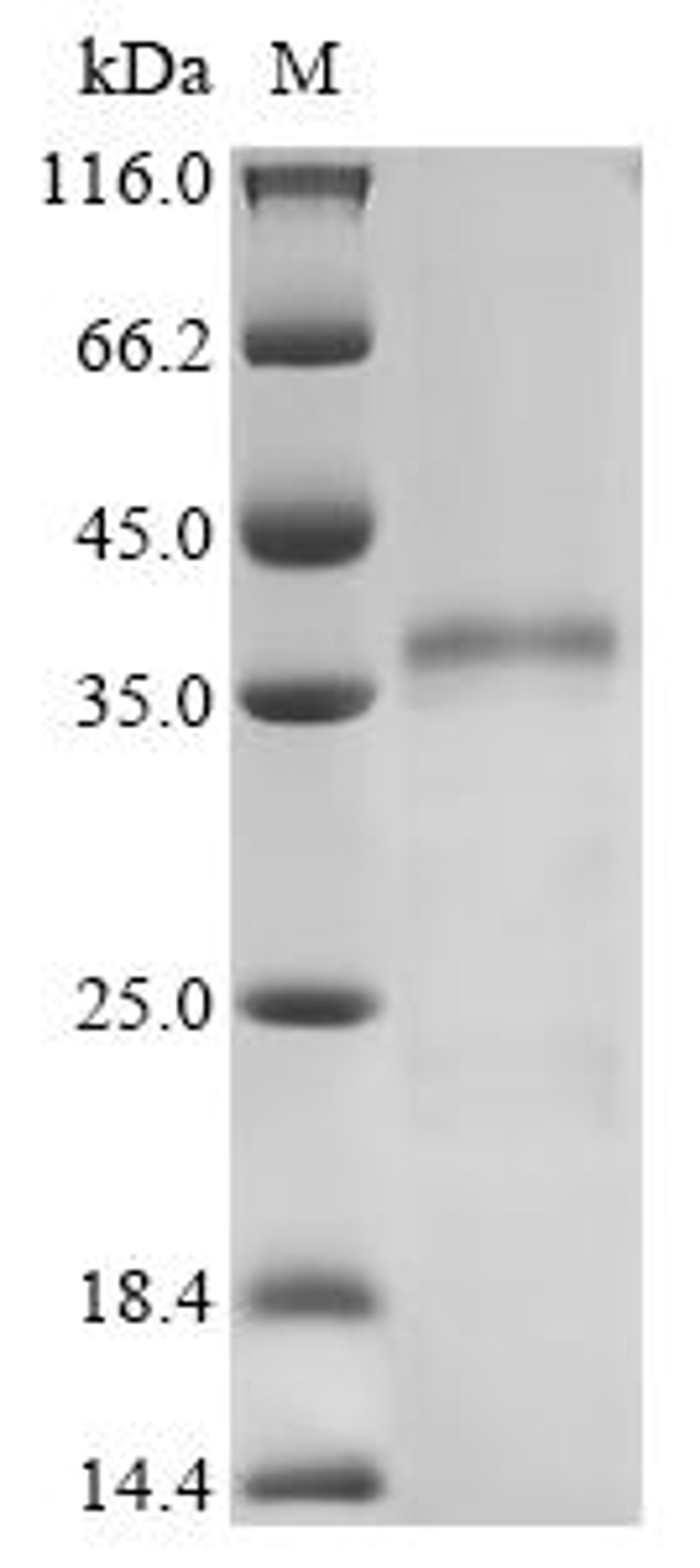 (Tris-Glycine gel) Discontinuous SDS-PAGE (reduced) with 5% enrichment gel and 15% separation gel.