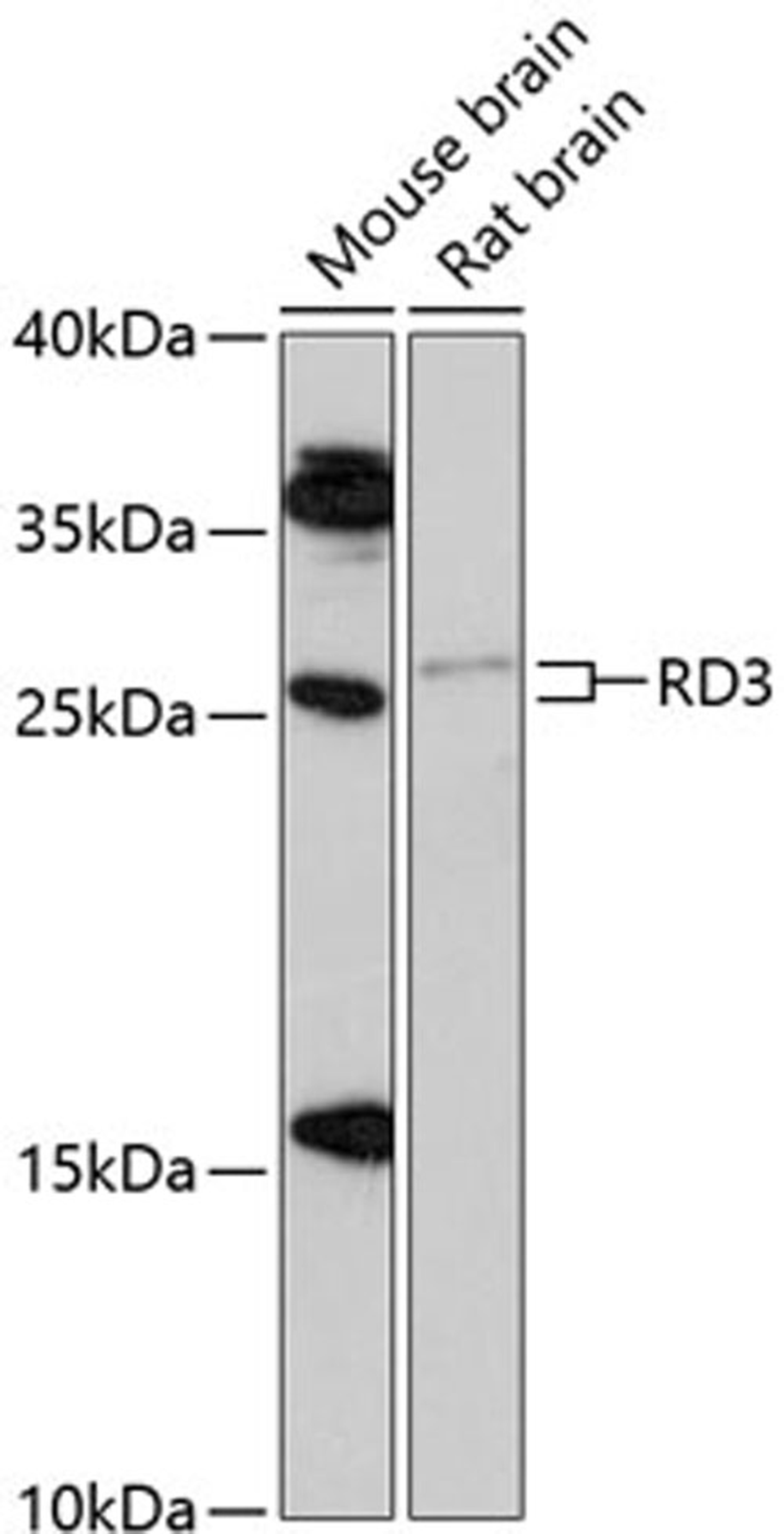 Western blot - RD3 antibody (A13165)