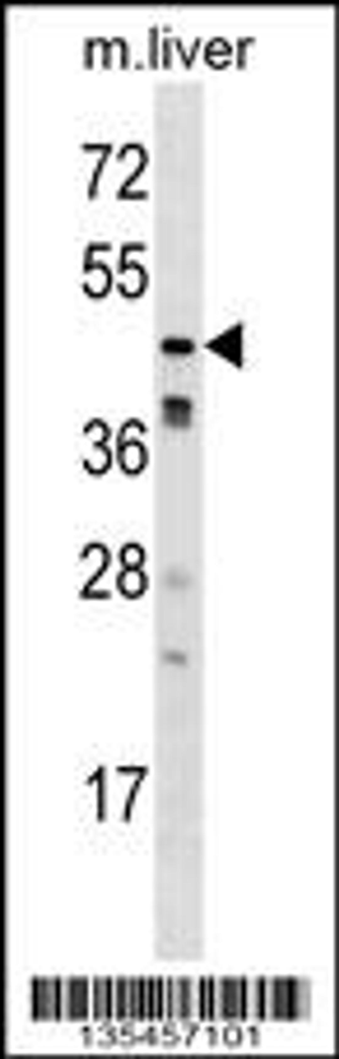 Western blot analysis in mouse liver tissue lysates (35ug/lane).