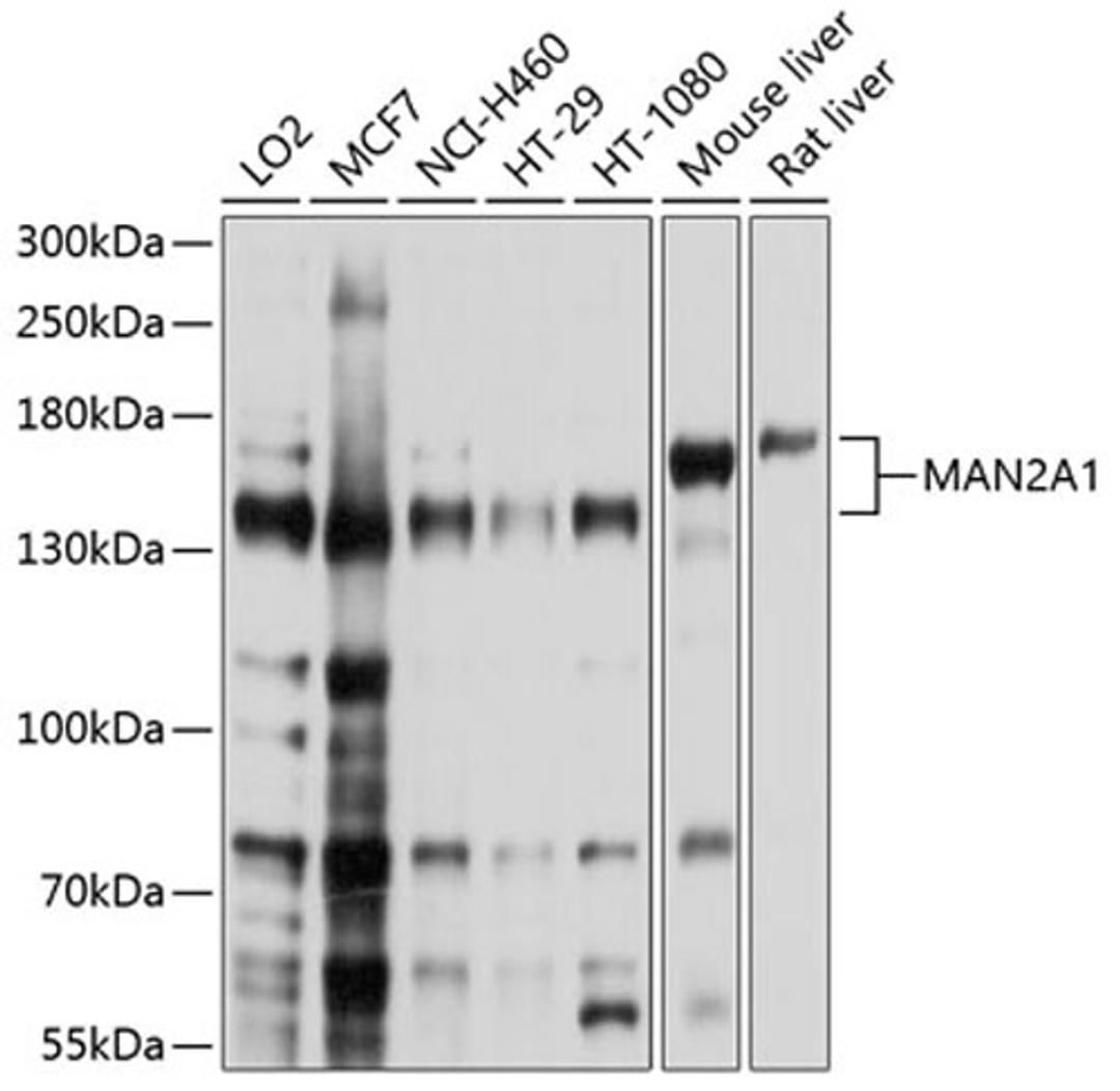 Western blot - MAN2A1 antibody (A10227)