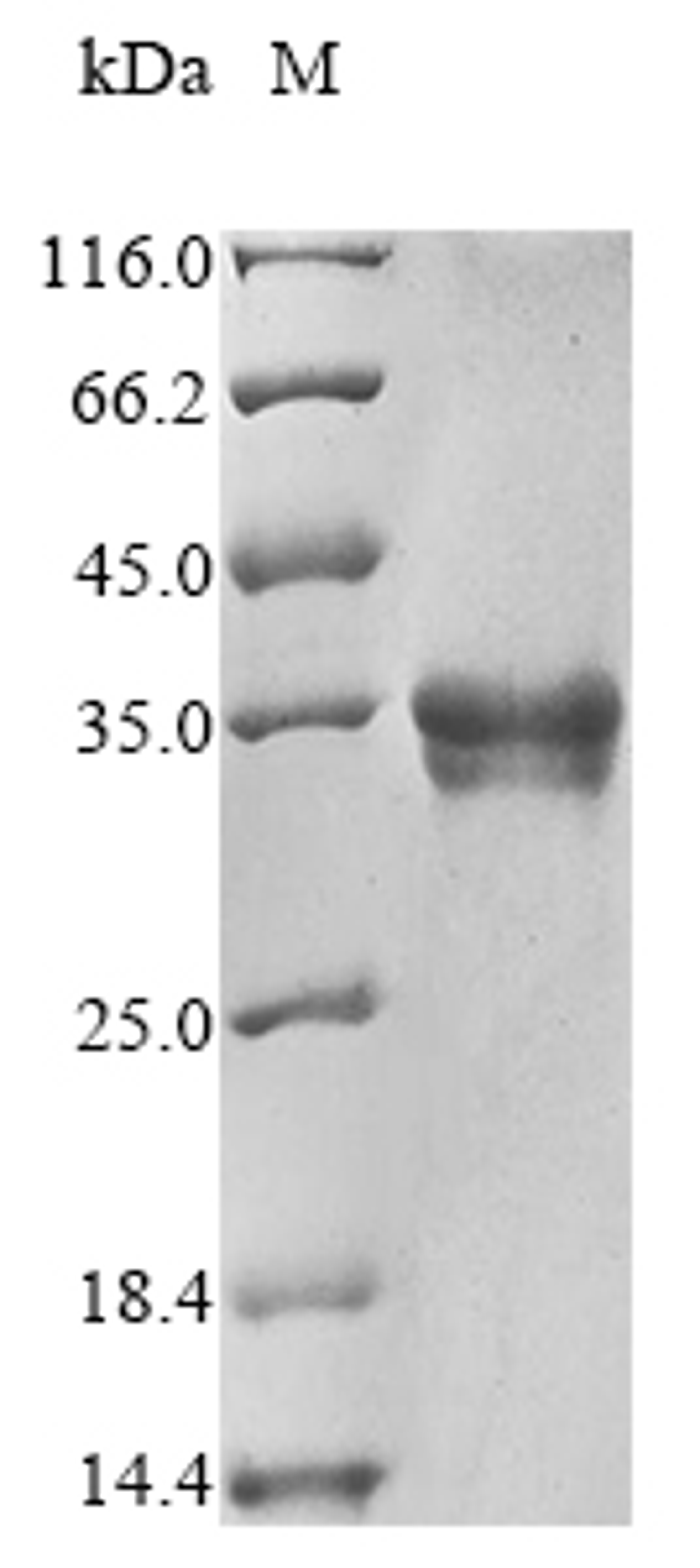 (Tris-Glycine gel) Discontinuous SDS-PAGE (reduced) with 5% enrichment gel and 15% separation gel.