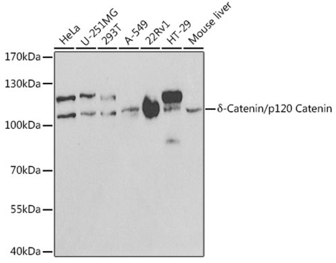 Western blot - d-Catenin/p120 Catenin antibody (A1641)