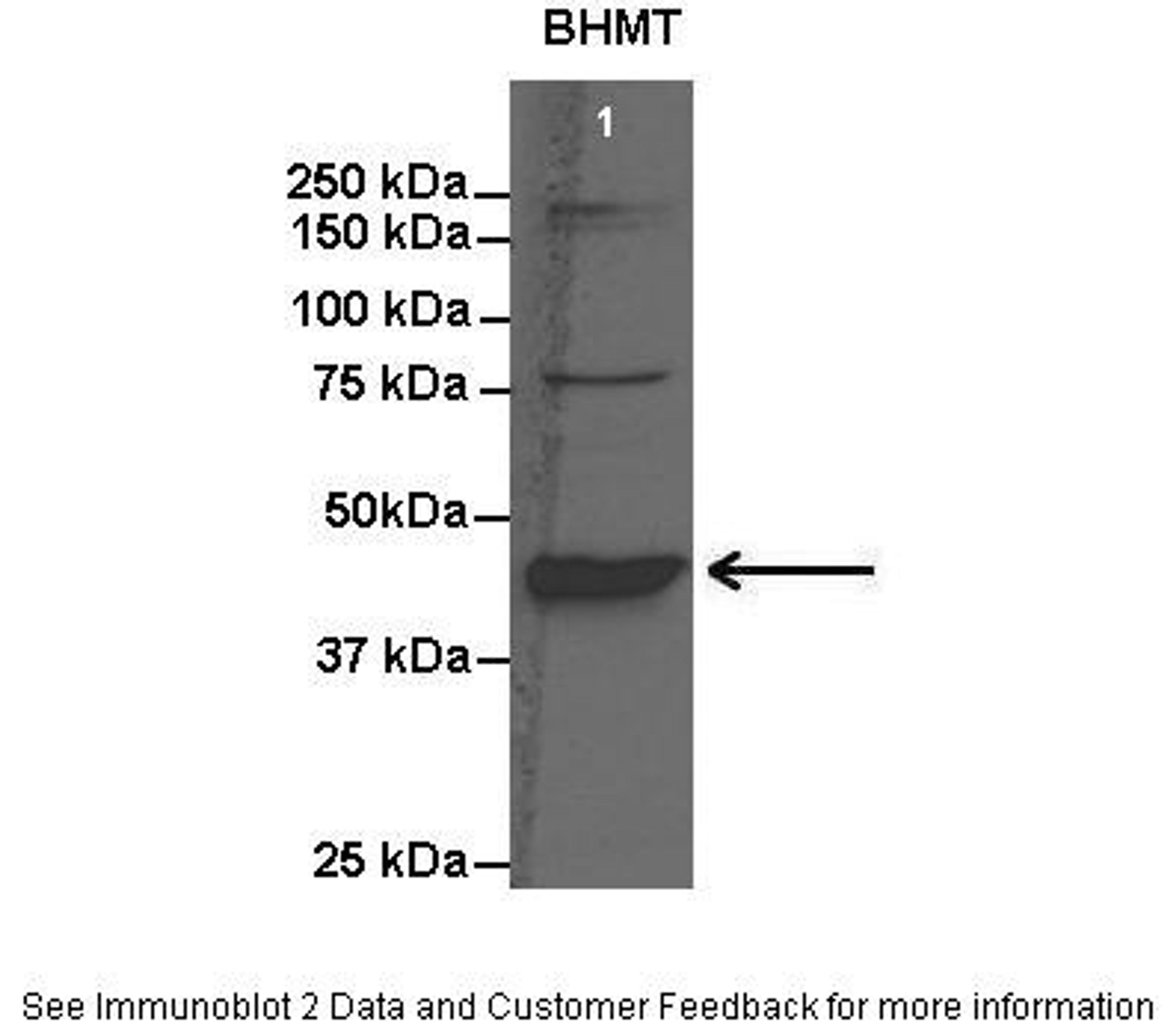 Antibody used in WB on Rat liver at: 1:1000.