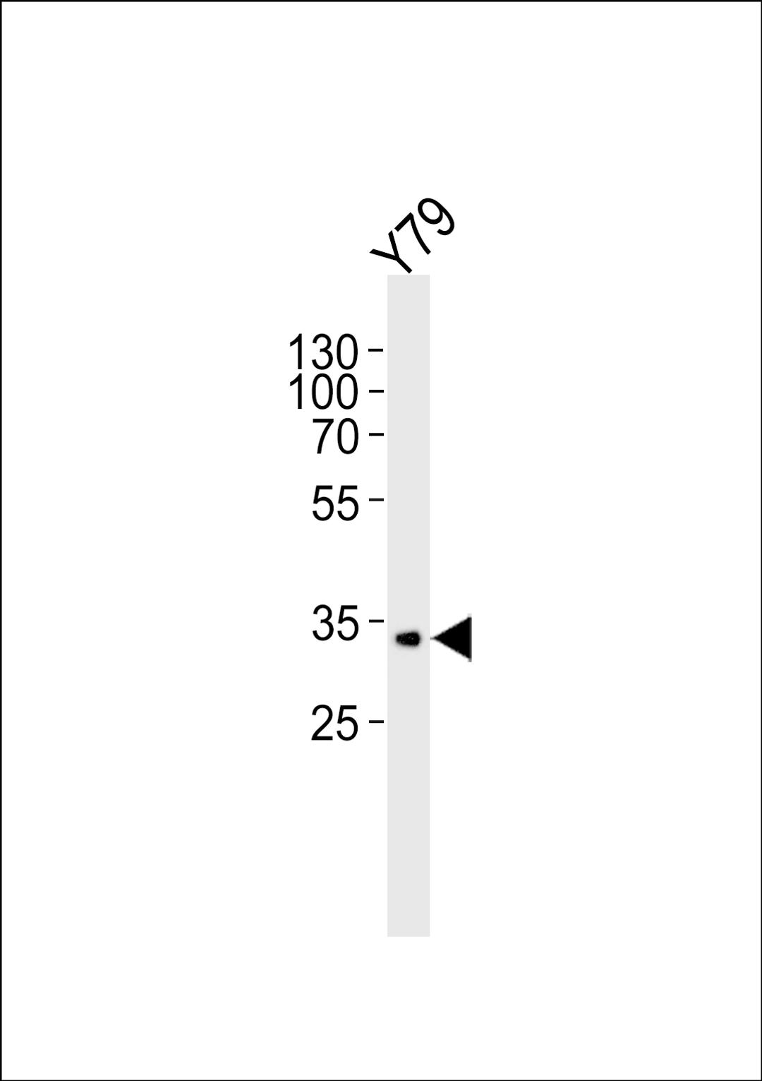 Western blot analysis of lysate from Y79 cell line, using CRX Antibody at 1:1000.