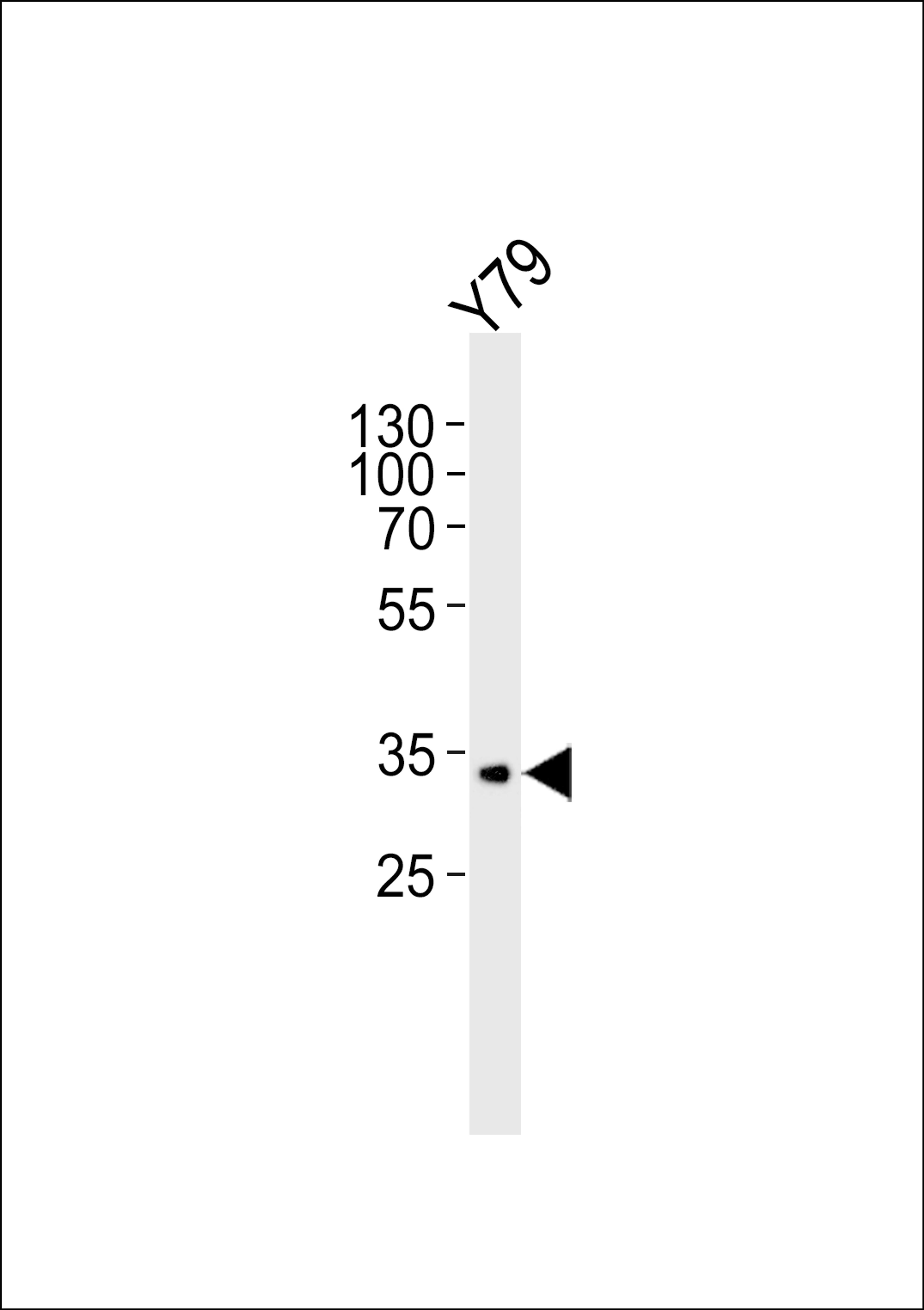 Western blot analysis of lysate from Y79 cell line, using CRX Antibody at 1:1000.