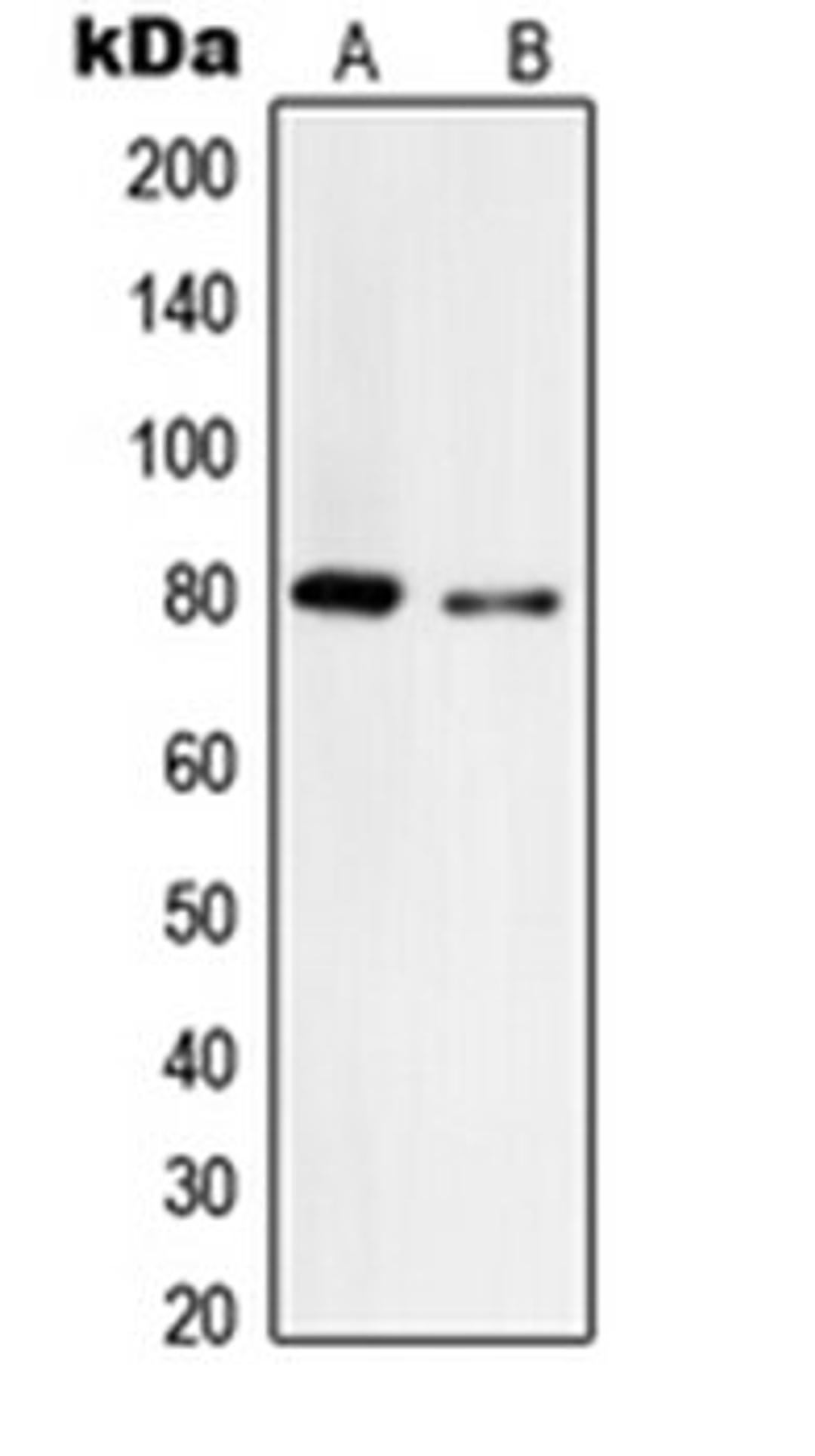 Western blot analysis of A375 (Lane 1), HepG2 (Lane 2) whole cell lysates using TYR antibody