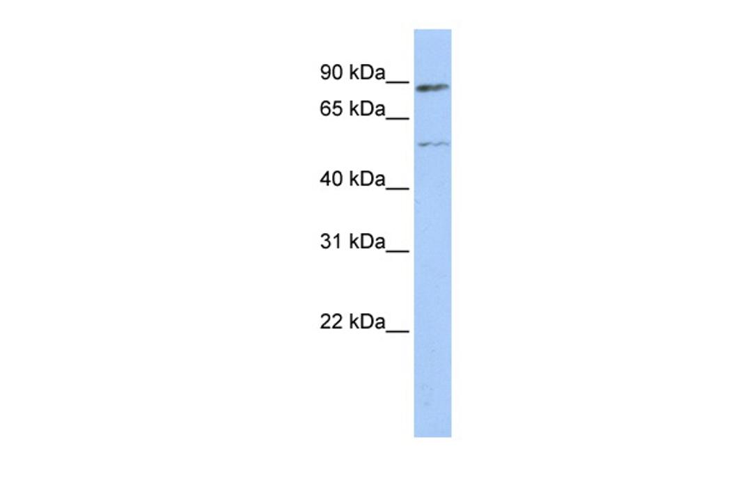 Antibody used in WB on Human HeLa at 0.2-1 ug/ml.