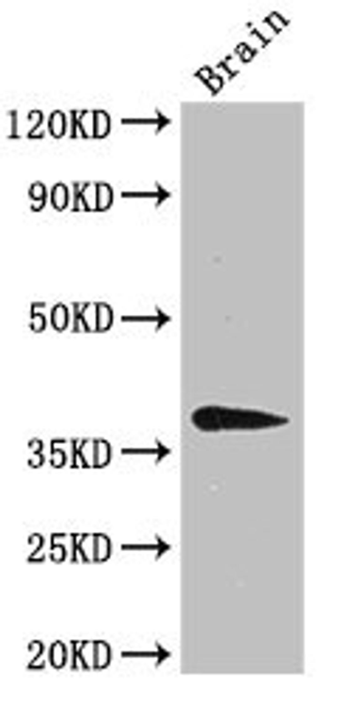 Western Blot. Positive WB detected in: Mouse brain tissue. All lanes: B4GALT7 antibody at 3ug/ml. Secondary. Goat polyclonal to rabbit IgG at 1/50000 dilution. Predicted band size: 38 kDa. Observed band size: 38 kDa.