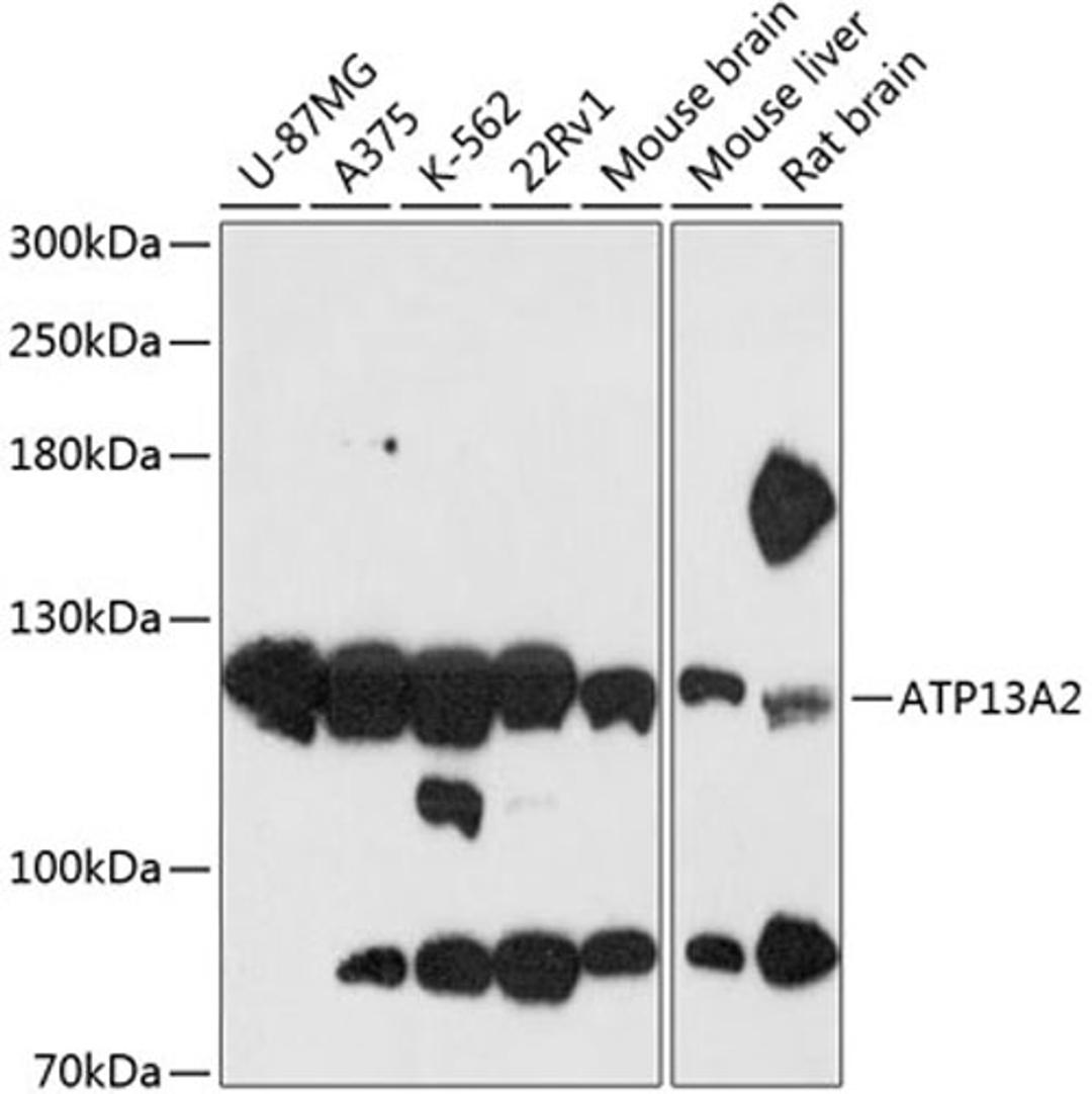 Western blot - ATP13A2 antibody (A13083)